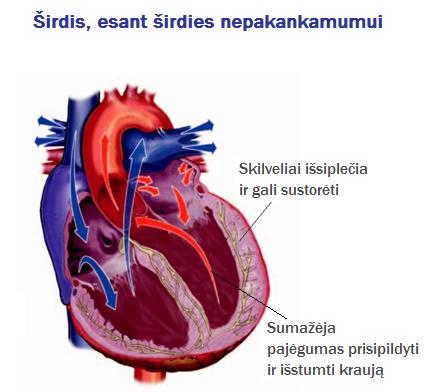 europos-sirdies-nepakankamumo-diena