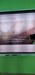 prevencine-pamokele-,,ka-svarbu-zinoti-apie-erkes?”